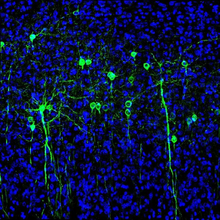 Microscope photograph of mouse brain cells, the neurons studied using optogenetics